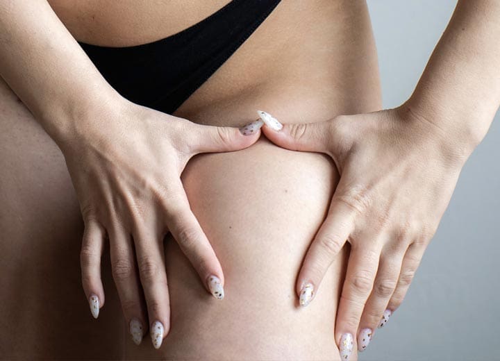 HR Plastic Sugery Loose excess thigh - leg skin